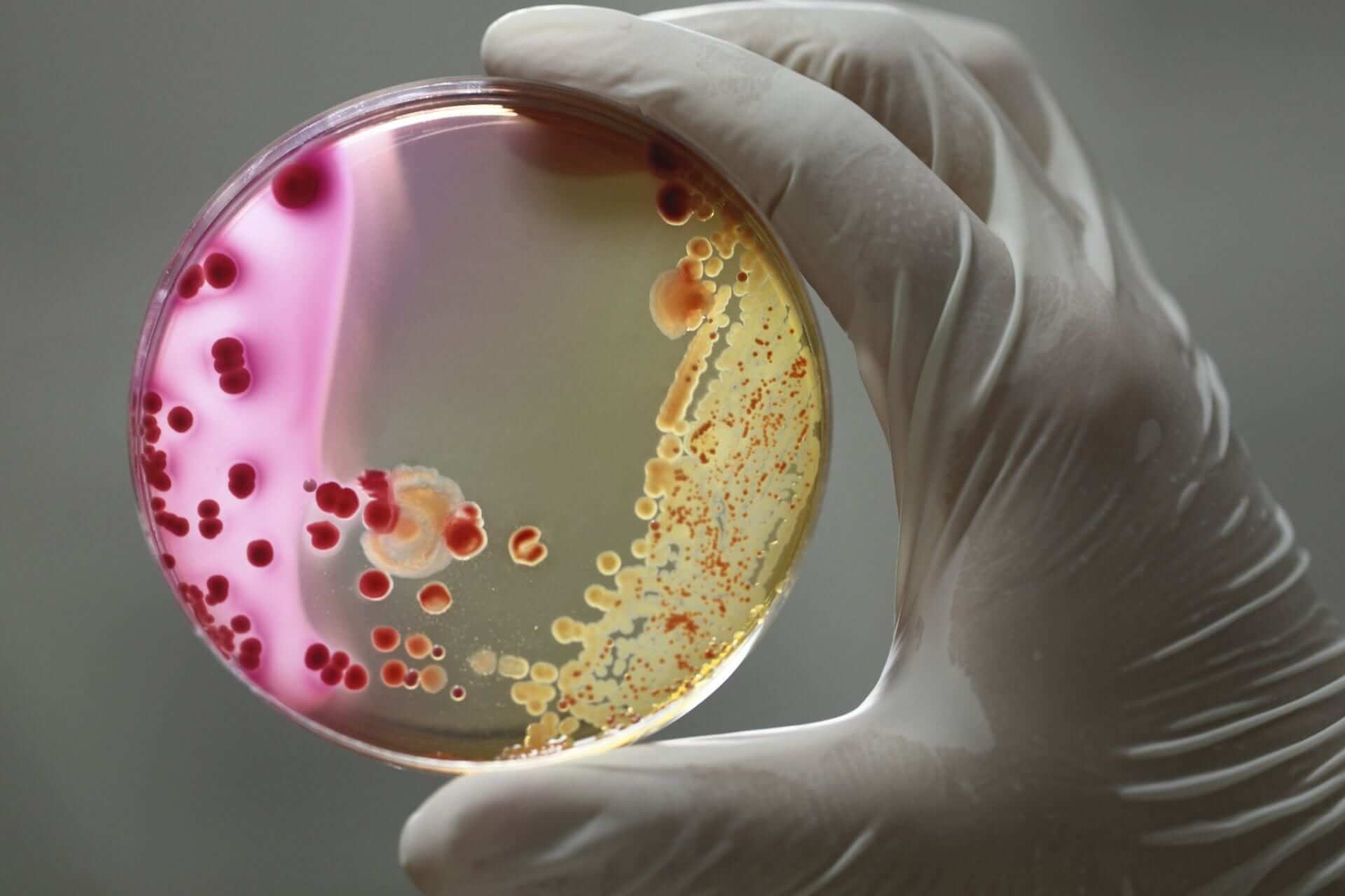 Борьба с патогенными бактериями
